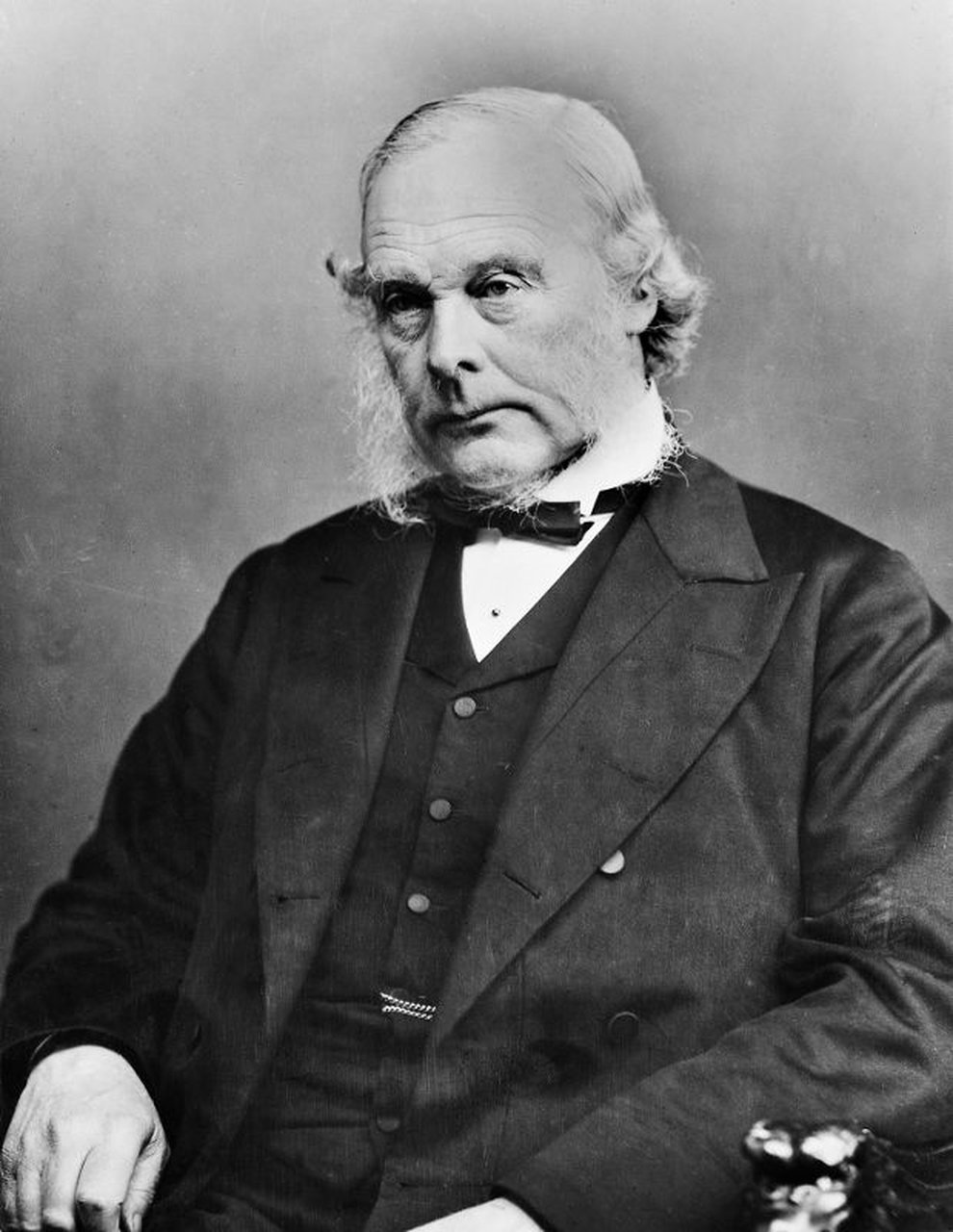 Joseph Lister